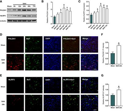 PHLDA1 modulates microglial response and NLRP3 inflammasome signaling following experimental subarachnoid hemorrhage